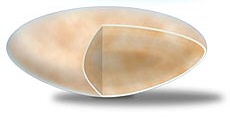 Cataract Lens