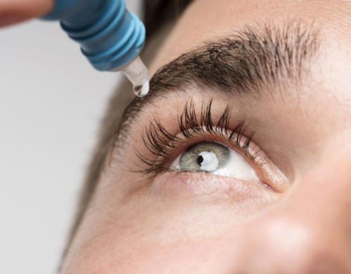 Dry Eye Syndrome Dry Eye Syndrome