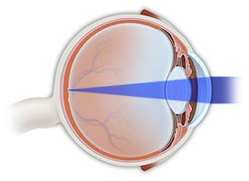 Normal Vision