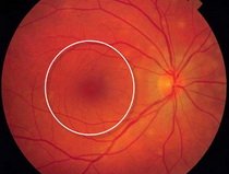 Normal Macula