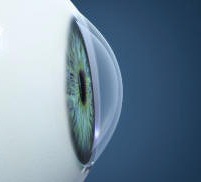 Healthy Cornea