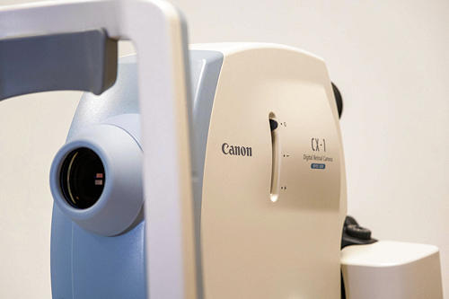 Fundus Fluorescein Angiography (FFA) Fundus Fluorescein Angiography (FFA)