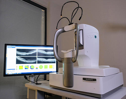 Optical Coherence Tomography (OCT) Optical Coherence Tomography (OCT)